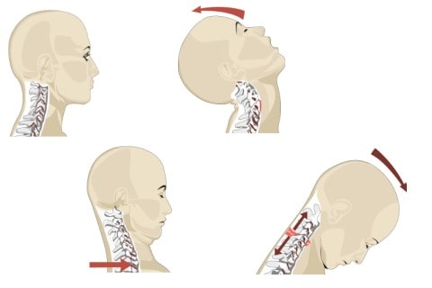 Whiplash Treatment - Suffolk Physical Therapy & Chiropractic