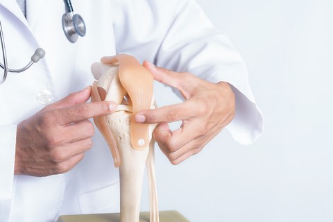 Picture of a orthopedic car accident doctor in Long Island holding a knee model.